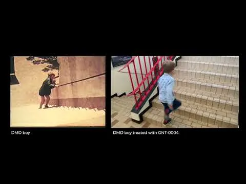 Kepper vs Sacha