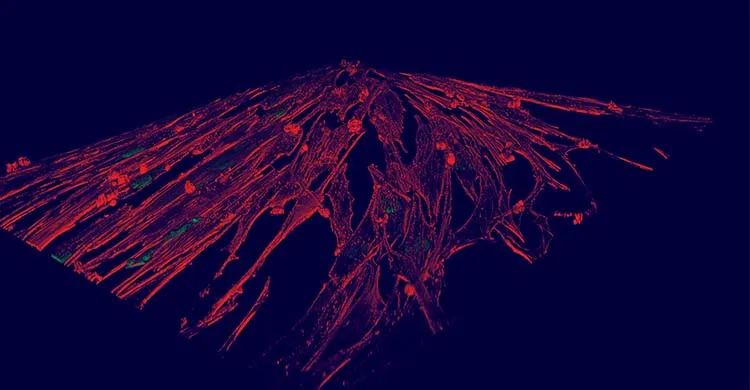 La révolution de la myologie par l'AFM-Téléthon qui en fait une discipline à part entière