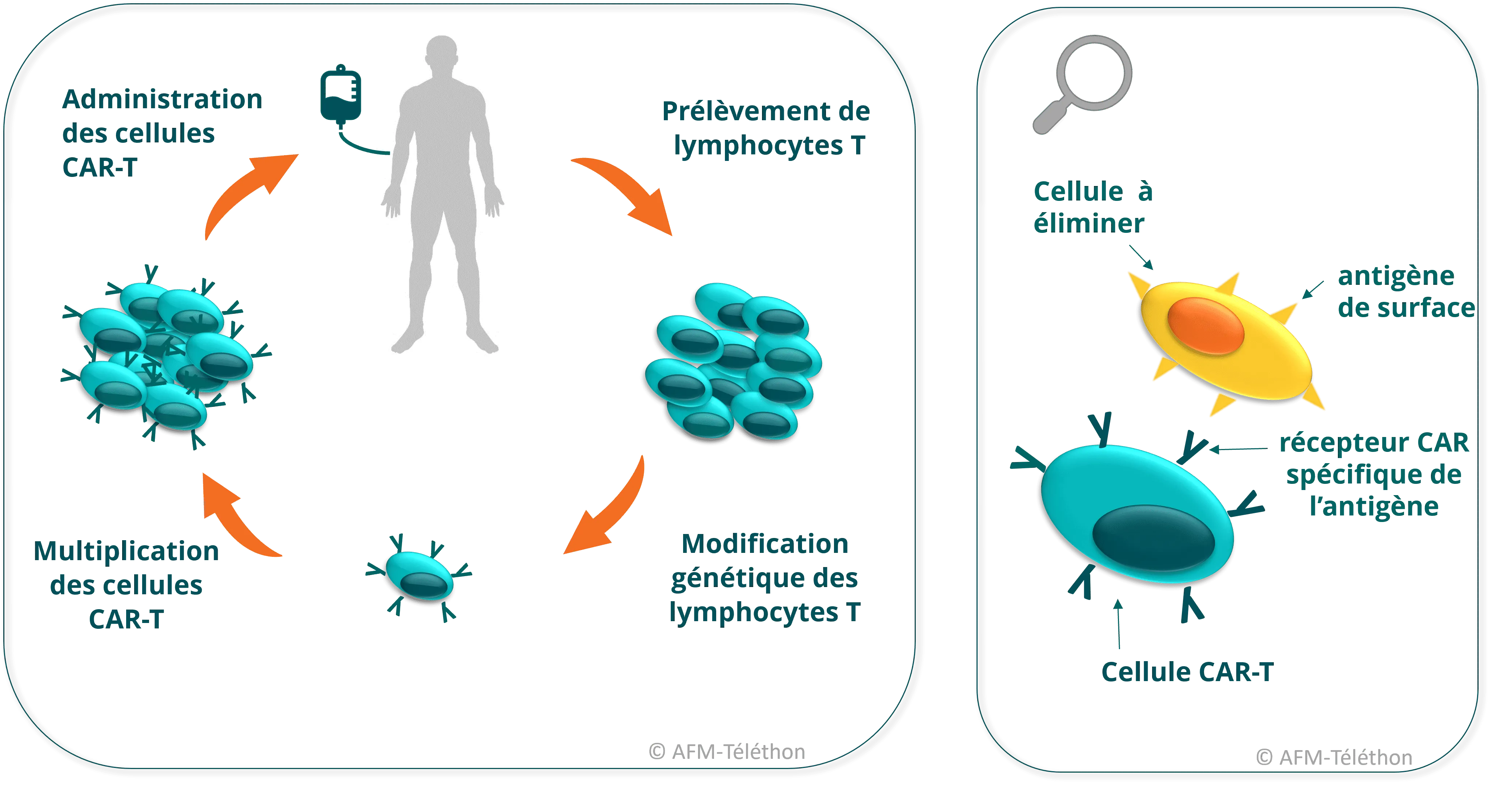 Infographie montrant les différentes étapes du traitement par cellules CAR-T, depuis le prélèvement des lymphocytes T jusqu'à leur modification, leur multiplication et leur réinjection pour éliminer les cellules ciblées.