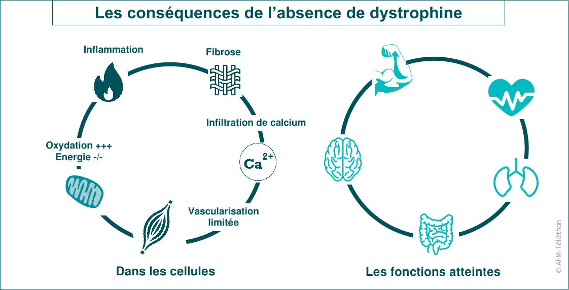 Les conséquences de l'absence de dystrophine sur les cellules et tissus (inflammation, fibrose, calcium...) et sur les fonctions de l'organisme (musculaire, cardiaque, respiratoire, cérébrale, digestive)