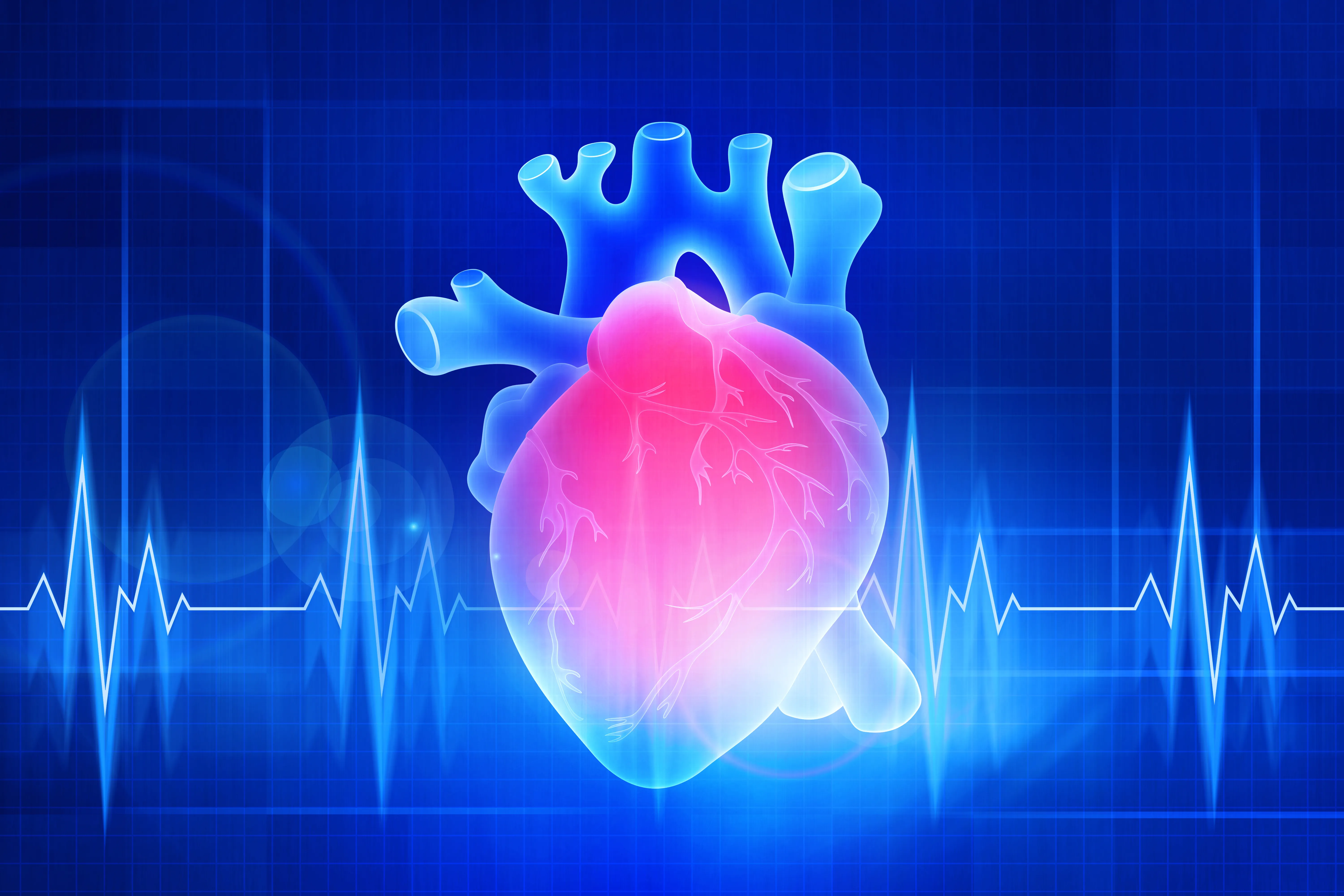 Coeur / assistance ventriculaire IDM