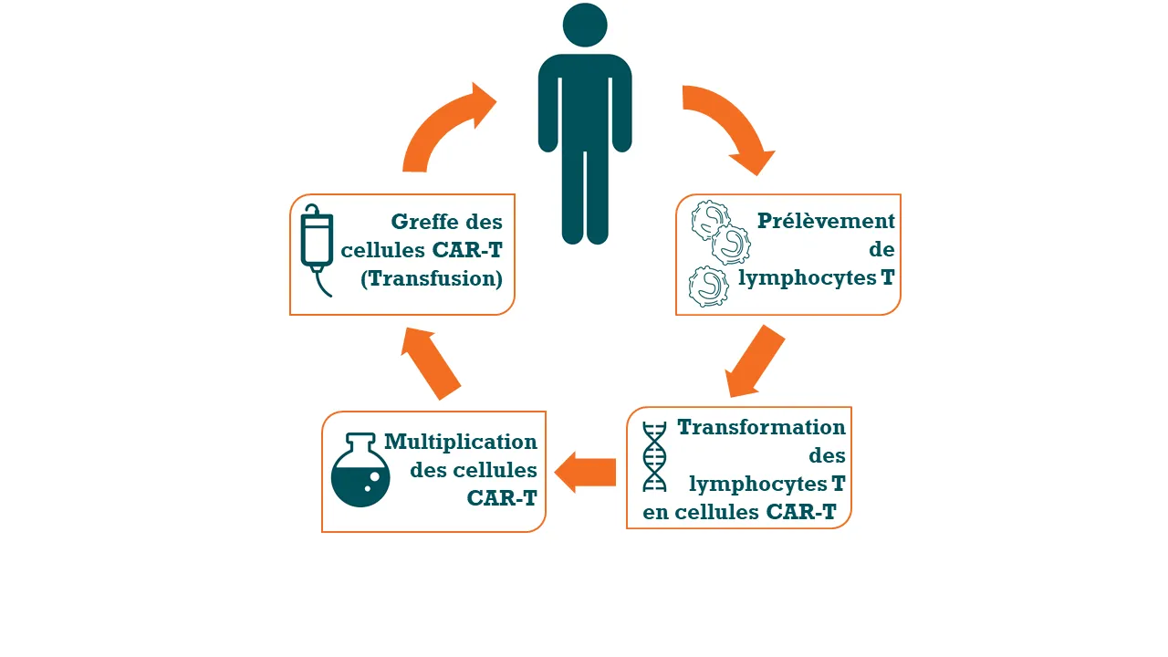 Infographie - Cellules CAR-T