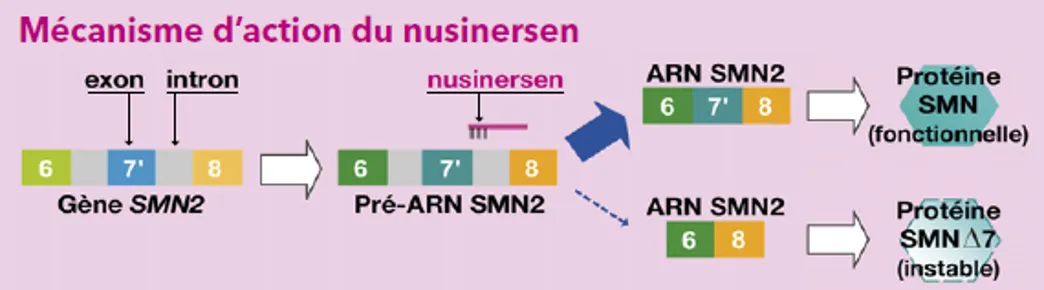 Infographie - Mécanisme d'action du nusinersen