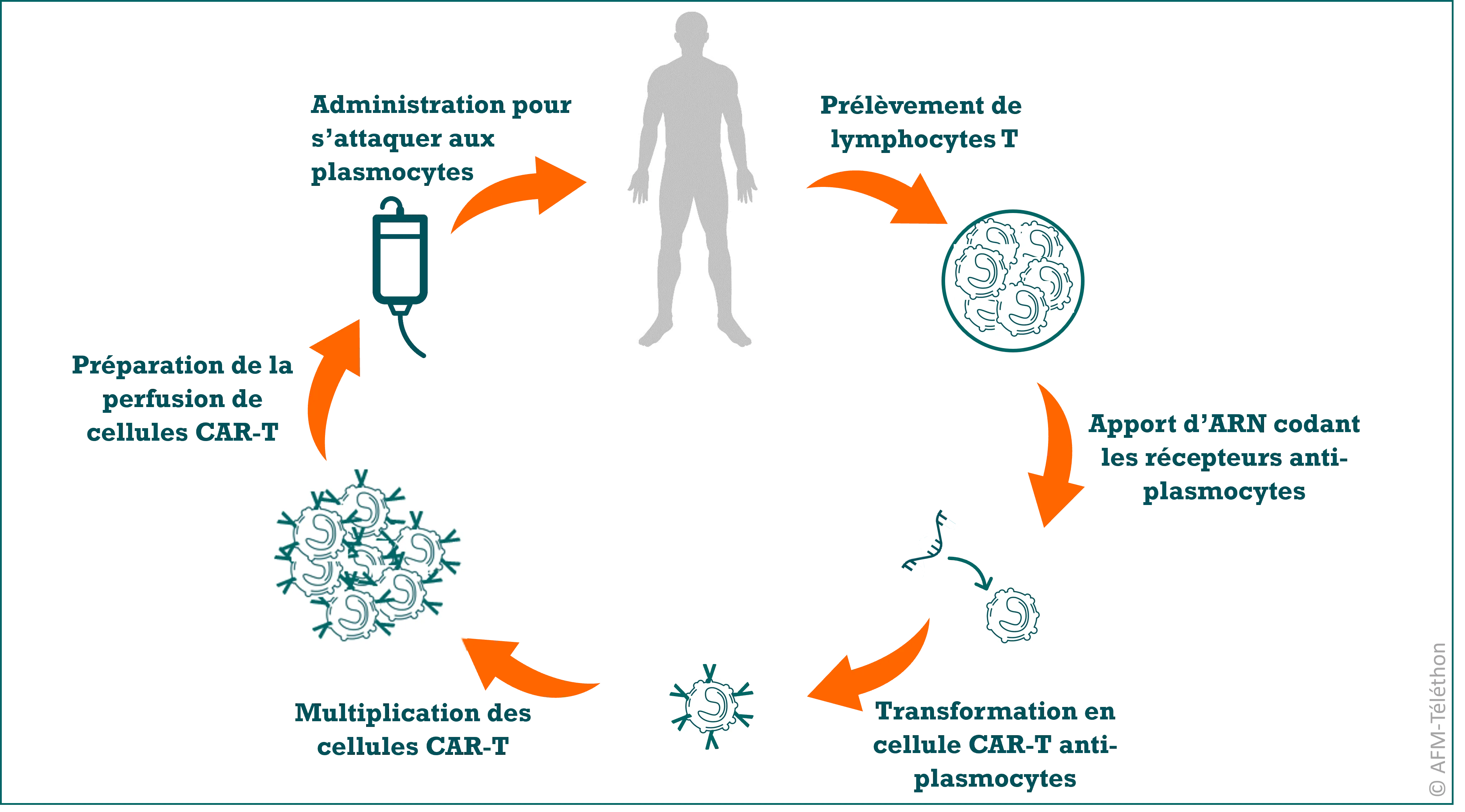 Infographie - Myasthénie CAR-T