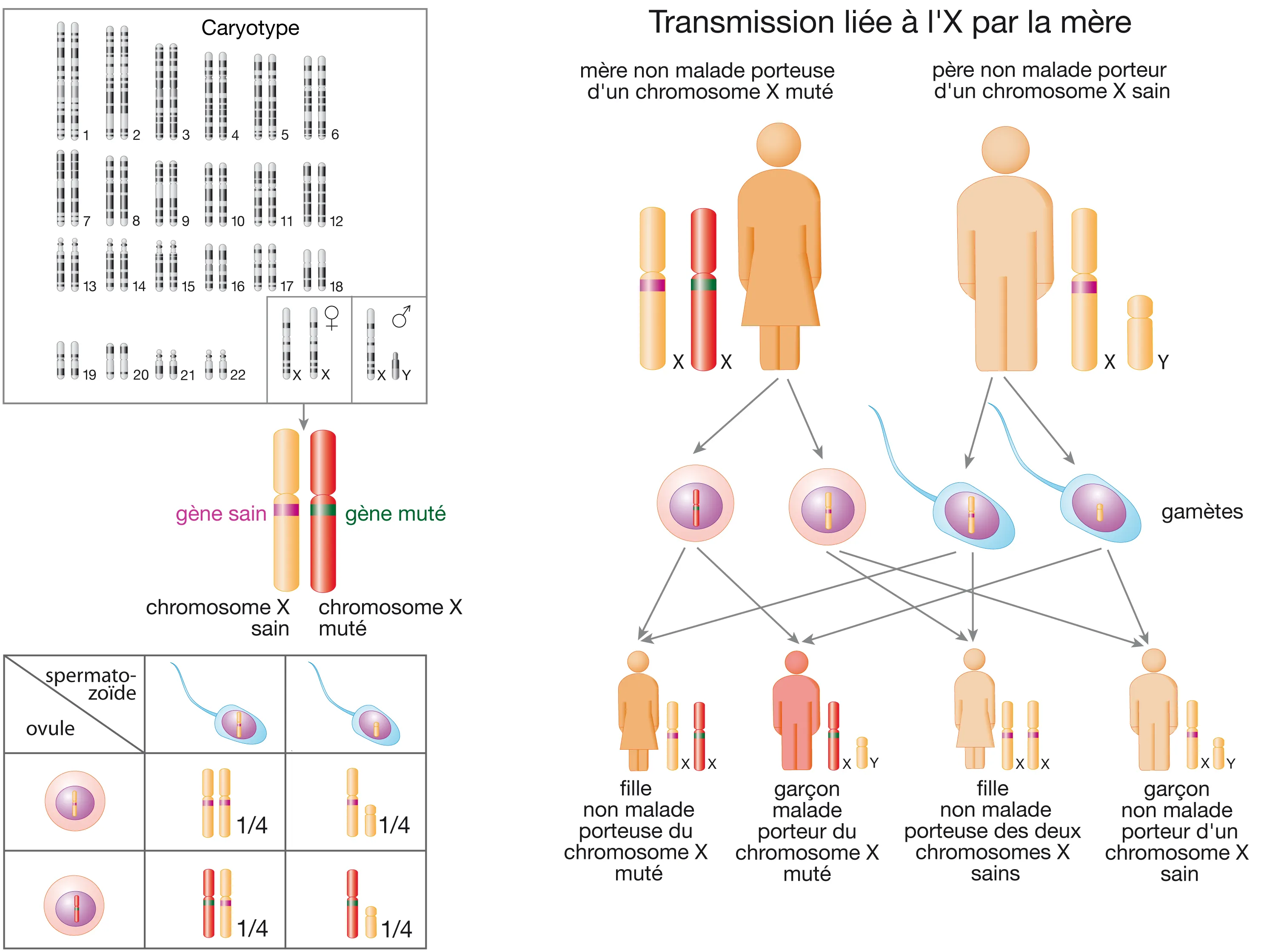 Comprendre comment se transmet une anomalie génétique lorsqu'elle est présente dans un gène situé sur un chromosome X